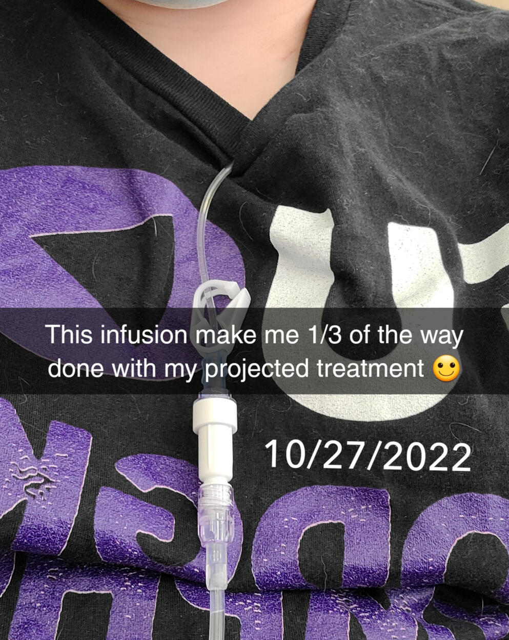 A snapchat selfie of my Hodgkin's lymphoma t-shirt featuring an infusion line (used for chemo). "This infusion make me 1/3 of the way done with my projected treatment" dated 10/27/2022.